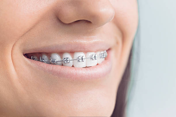Best Dental Inlays and Onlays  in Sherrill, NY